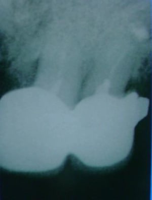 Fac 5989 yyfmas - Eugenol