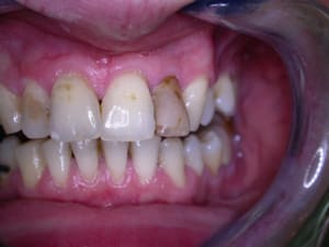 Farley01 n3jgpa - Eugenol