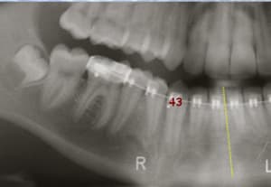 Fin 43 ein52k - Eugenol