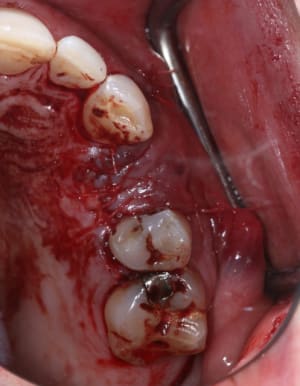 Fin vue sup wzswyl - Eugenol