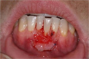 Gec6 ohi6lj - Eugenol