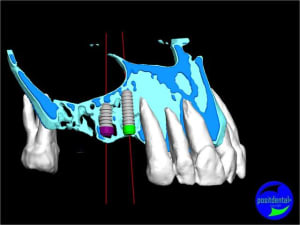 Guide chirurgical 003 capvkz - Eugenol
