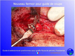 Guide d ost otomie  positionneur fibula positdental005 hoerf5 - Eugenol