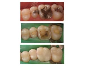 Hg ou compo v2glhc - Eugenol