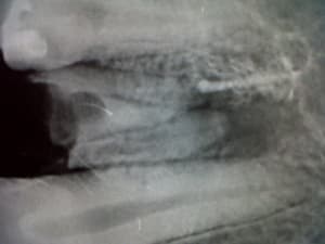 Img00356 20120214 2013 jmln0w - Eugenol
