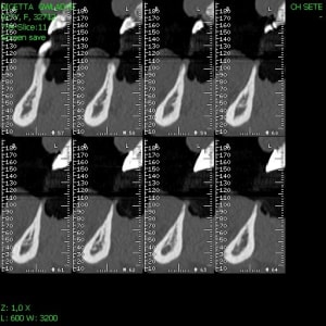 Img10 ch8xza - Eugenol