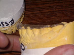 Imgp0645 pkqepy - Eugenol