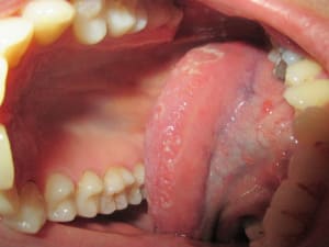 Img 0040 jgfcef - Eugenol