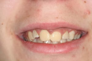 Img 0044 ygpyho - Eugenol