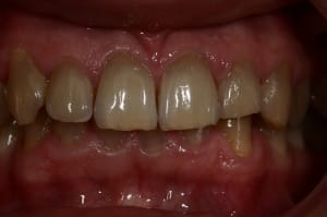 Img 0050 r960vw - Eugenol
