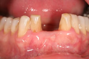 Img 0066 bpmgnj - Eugenol