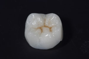 Img 0123 pl9j4e - Eugenol