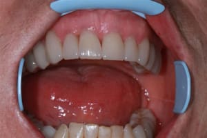 Img 0186 oohk8s - Eugenol