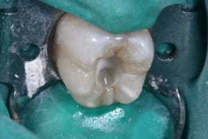 Img 0250 wpye78 - Eugenol