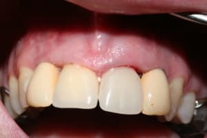 Img 0388 hw8fio - Eugenol