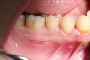 Img 0411 vsiwjh - Eugenol