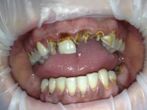 Img 0426 ixiy3t - Eugenol