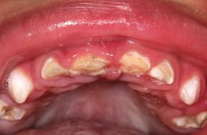 Img 0488 go9thr - Eugenol