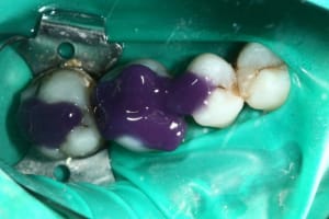 Img 0549 aek6oa - Eugenol