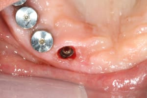 Img 0555 ef8hqk - Eugenol