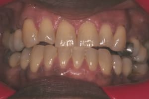 Img 0659 ilx9u6 - Eugenol