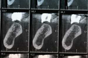 Img 0694 mjna0u - Eugenol