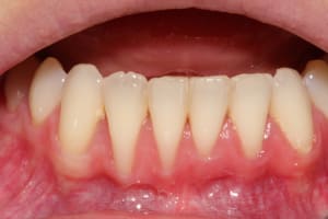 Img 0737 ztomwi - Eugenol