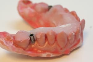 Img 0754 uj6zmp - Eugenol