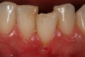 Img 0817 x88tgc - Eugenol