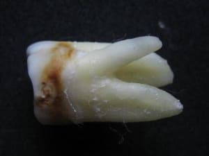 Img 0822 hracqt - Eugenol