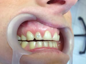 Img 0845 hcjlsf - Eugenol