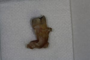 Img 0864 twip4w - Eugenol