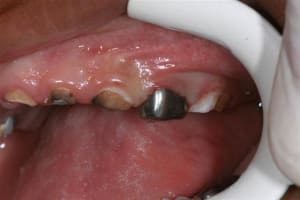 Img 0918  medium  fzvxmp - Eugenol