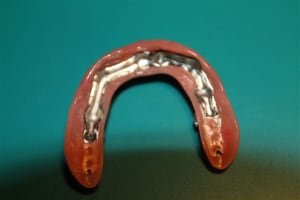 Img 0925 icraiw - Eugenol