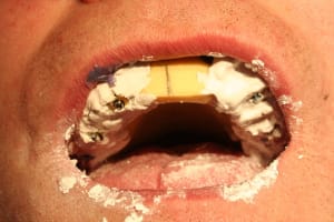 Img 0926 wkbes2 - Eugenol