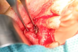 Img 0947 v30pox - Eugenol