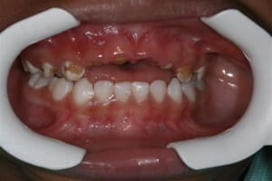 Img 0965  small  ew2zyp - Eugenol