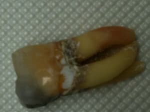 Img 1018 up595v - Eugenol