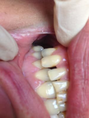 Img 1063 ntmcsm - Eugenol