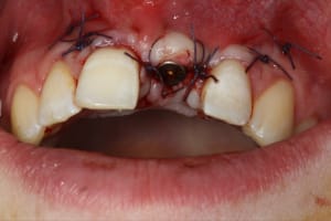 Img 1079 nhveyg - Eugenol
