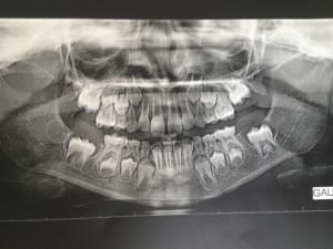 Img 1181 2014 08 25 10 53 32 chxjw2 - Eugenol