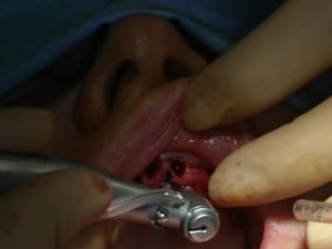 Img 1221 ybmitn - Eugenol