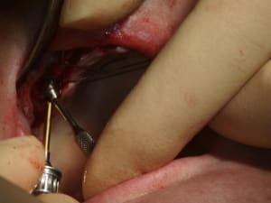 Img 1237 u8nnrh - Eugenol