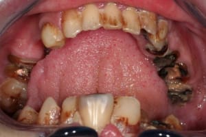 Img 1254 qufvep - Eugenol