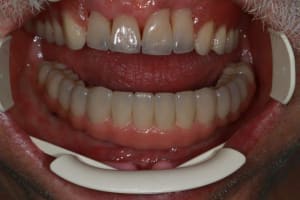 Img 1273 v5kibq - Eugenol