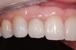 Img 1338 nhn3z6 - Eugenol