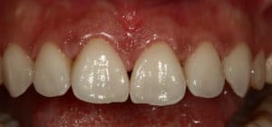 Img 1342 yfzqk7 - Eugenol
