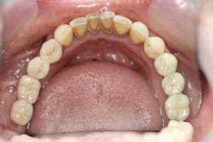 Img 1636 qzhneq - Eugenol