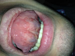 Img 1709 k9vjll - Eugenol