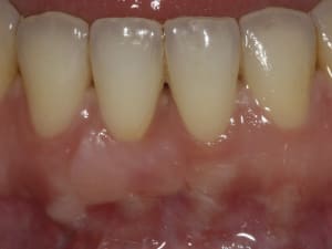 Img 17834 hp5kel - Eugenol